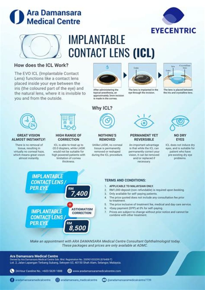 眼内コンタクトレンズで失敗しないために知るべき原因と対策